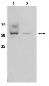 Anti-CYP450 Antibody, clone 2E1 