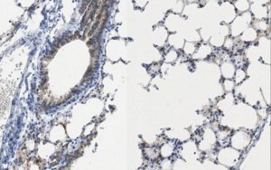 Anti-Cytokeratin 19 Antibody, clone TROMA-3 