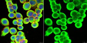 Anti-Cytokeratin 8/18 Antibody, clone L2A1 