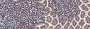 Anti-Cytokeratin-20 Antibody, clone XQ1 