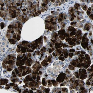 Anti-DCP1A antibody produced in rabbit 
