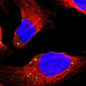 Anti-DCP1A antibody produced in rabbit 