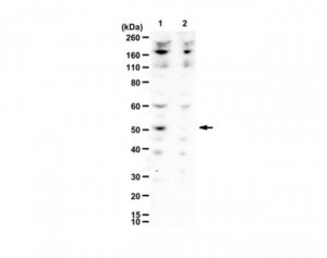 Anti-Dcp2 