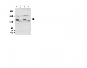 Anti-Dcp2 