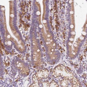 Anti-DDOST antibody produced in rabbit 