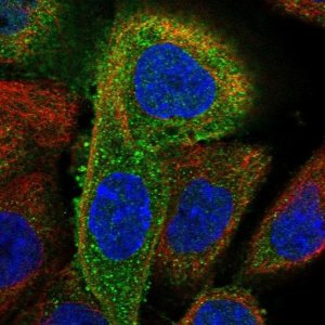 Anti-DDX58 antibody produced in rabbit 