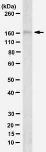 Anti-Desmoglein 2 Antibody, clone 6D8 