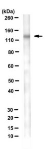 Anti-Desmoglein 3 Antibody, clone 5H10 