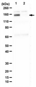 Anti-DNA helicase B (HELB) 