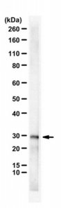 Anti-DsbA-L 