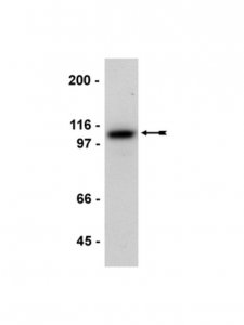 Anti-E-Cadherin Antibody 