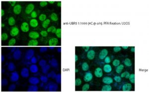Anti-E3 ubiquitin-protein ligase (UBR5/EDD) 