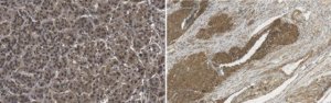 Anti-E3 ubiquitin-protein ligase RNF31 