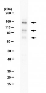 Anti-E3 ubiquitin-protein ligase RNF31 