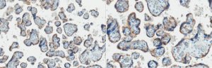 Anti-EGFR Antibody 