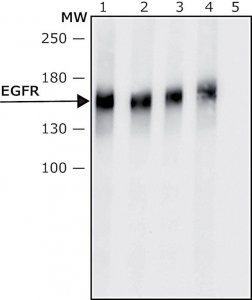 Anti-Epidermal Growth Factor (EGF) Receptor antibody, Mouse monoclonal 