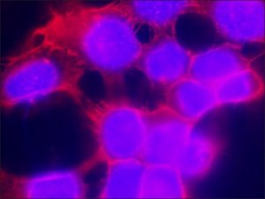 Anti-Epidermal Growth Factor (EGF) Receptor, Mouse monoclonal 