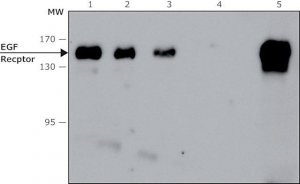 Anti-Epidermal Growth Factor (EGF) Receptor, Mouse monoclonal 