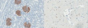 Anti-Epithelium Endothelial Cells Antibody, clone PHM-5 