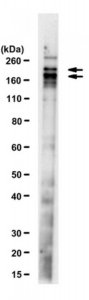 Anti-ESET (SETDB1) Antibody, clone F0808 