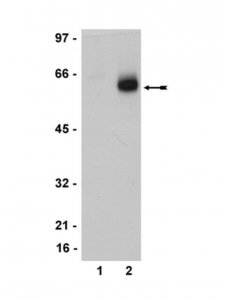 Anti-Estrogen Receptor Antibody, clone 68-4, rabbit monoclonal 