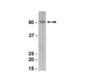 Anti-Estrogen-related Receptor Antibody 