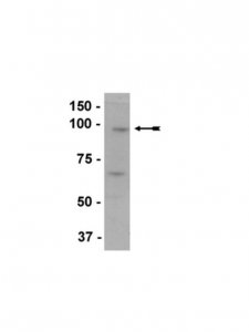 Anti-EZH2 Antibody 