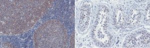 Anti-FANCD2 Antibody, clone 10F8.1 