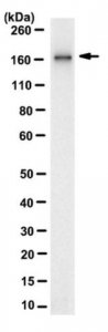 Anti-FANCD2 Antibody, clone 10F8.1 