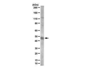 Anti-Ferrochelatase 