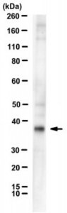 Anti-FGF23 Antibody, clone 278-2 