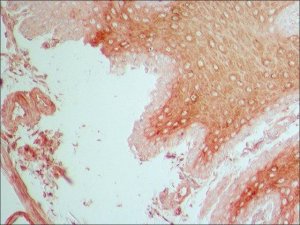 Anti-Fibroblast Growth Factor Receptor-1 antibody produced in rabbit 