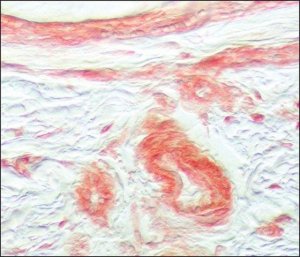 Anti-Fibroblast Growth Factor Receptor-1 antibody produced in rabbit 