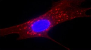 Anti-Fibroblast Surface Protein antibody, Mouse monoclonal 