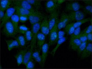 Anti-FKHRL1 (FOXO3a) antibody produced in rabbit 