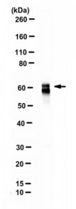 Anti-GAD 65/67 