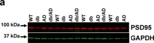 Anti-Glial Fibrillary Acidic Protein antibody produced in rabbit 
