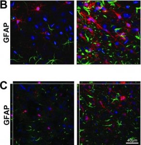 Anti-Glial Fibrillary Acidic Protein Antibody, clone GA5 