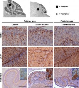 Anti-Glial Fibrillary Acidic Protein Antibody, clone GA5 
