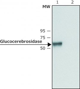 Anti-Glucocerebrosidase (C-terminal) antibody produced in rabbit 