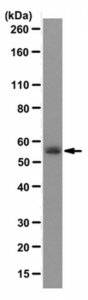 Anti-GLUT1 (CT) Antibody, clone 5B12.3 