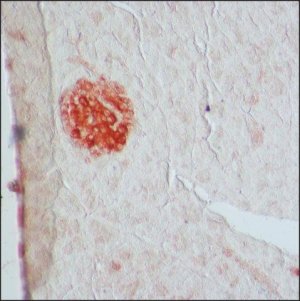 Anti-Glutamic Acid Decarboxylase 65/67 antibody produced in rabbit 
