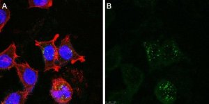 Anti-Golgi Zone Antibody, clone 371-4 