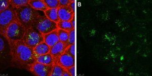 Anti-Golgi Zone Antibody, clone 371-4 
