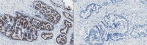 Anti-GOLM1 Antibody, clone 6A2 
