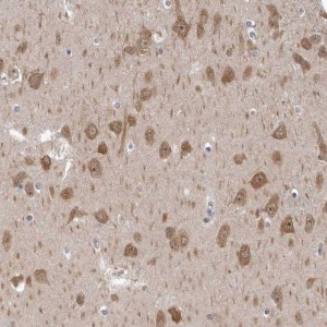Anti-GSK3B antibody produced in rabbit 