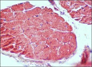 Anti-Guanylyl Cyclase 1 antibody produced in rabbit 