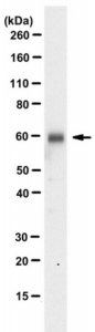 Anti-Heparanase-1 