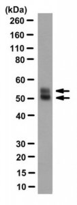 Anti-Herpes Simplex Virus Glycoprotein D Antibody, clone LP14 
