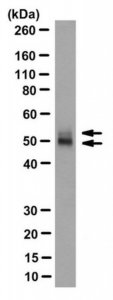 Anti-Herpes Simplex Virus Glycoprotein D Antibody, clone LP14 